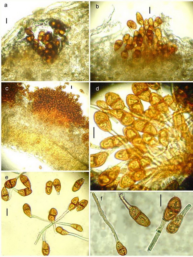 Puccinia's microscopic characteristics: rust, brown teardrop shaped heads with a tail of light green in clusters